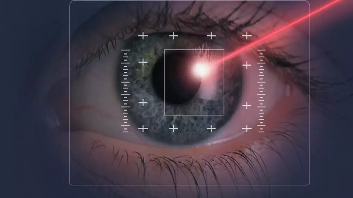 laser do korekcji wzroku