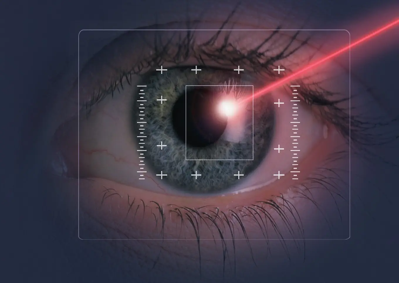 laser do korekcji wzroku